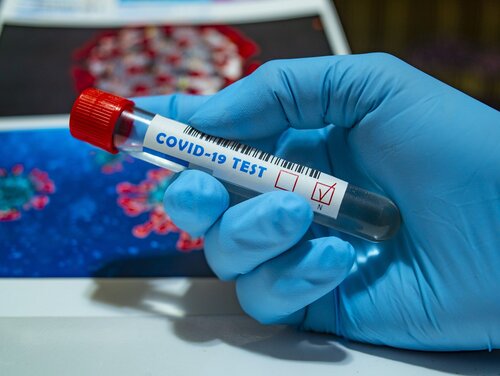 Covid-19-Test Coronavirus